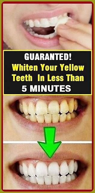 Guaranteed Whiten Your Yellow Teeth In Less Than 2 Minutes Healhty And Tips