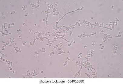 Budding Yeast Cell Structure Fine Microscope Stock Photo