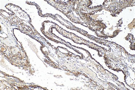 Cytokeratin Antibody Rr Proteintech