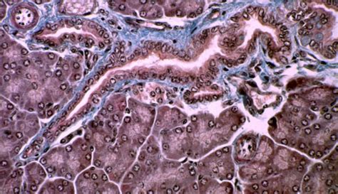 Histologie Etude Au Microscope Entrainement De Coupes Glandes Exocrines