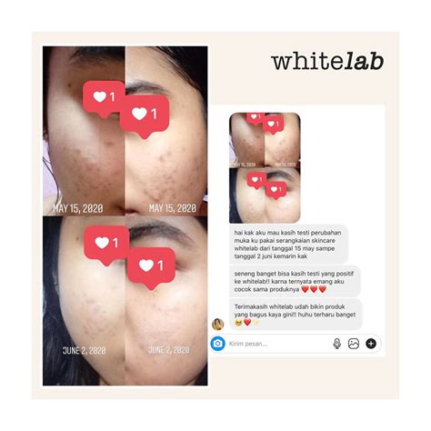 Whitelab N Dose Brightening Serum Niacinamide