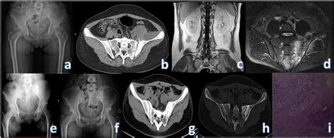 Preoperative X Ray Ct And Mri Of The Patient As Well As X Ray At Download Scientific Diagram