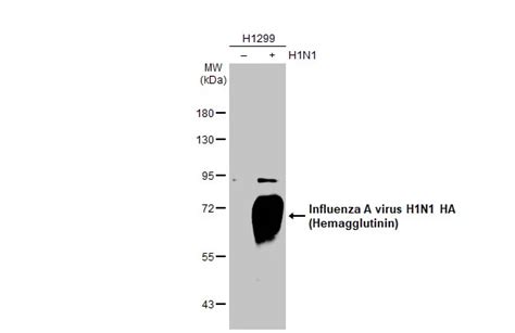 Influenza A virus H1N1 HA Hemagglutinin 抗体 GTX127357 GeneTex中国官方网站