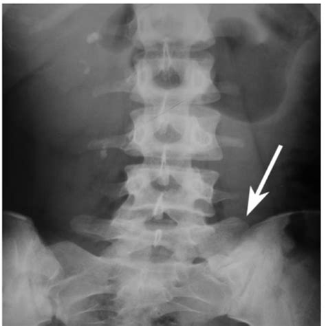 Week Clinical Imaging Flashcards Quizlet