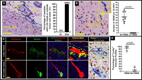 Decreasing TMEM Doorway Function Suppresses TMEM Mediated Vascular