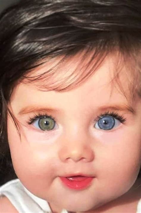 Enchanting Allure Captivating Babies With Heterochromia And