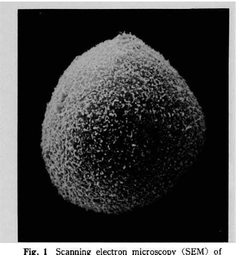 Figure 1 From The Cytotoxicity Of Chenodeoxycholic Acid CDCA And