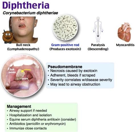 Nte®️n🅰️l Ⓜ️edℹ©️ℹne On Twitter Diphtheria A Serious Bacterial