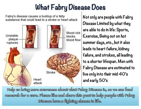 Fabry Disease