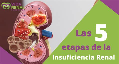 Insuficiencia Renal Cronica Etapas