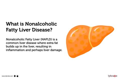 Hepatic Steatosis What Is It Causes Diagnosis 46 Off