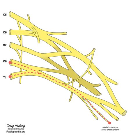 Medial Antebrachial Cutaneous Nerve - WikiMSK