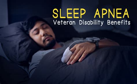 Securing Veteran Disability Benefits For Sleep Apnea Your 3 Essential