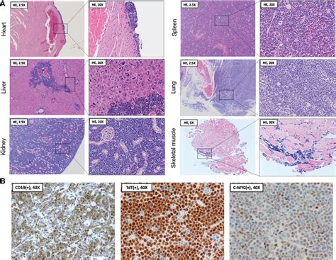 Histopathological And Immunohistochemical Analysis Of Organs Following