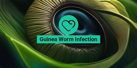 Guinea Worm Infection: Causes, Symptoms, and Treatment Options • Yesil ...