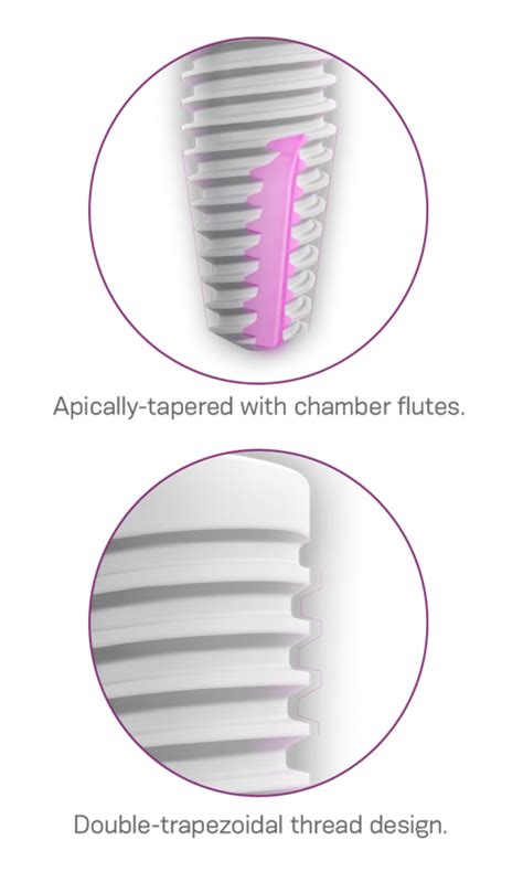 Neodent Zi Ceramic Implant System A New Mindset