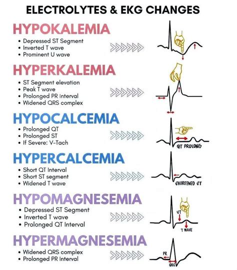 Electrolytes And EKG Changes MEDizzy