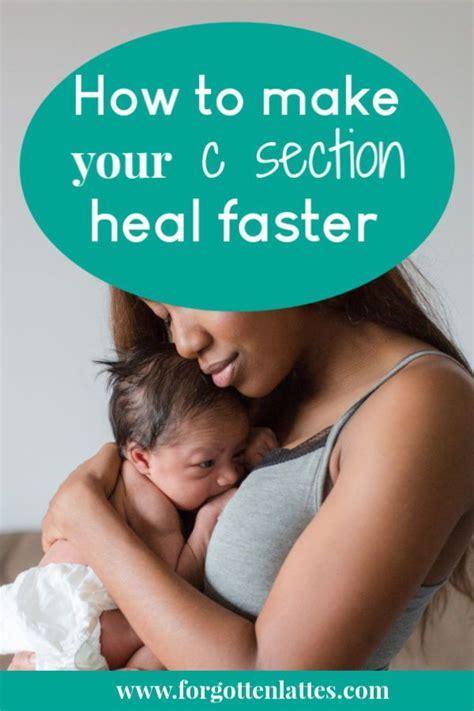 C Section Recovery Timeline A Week By Week Look At Recovery Artofit