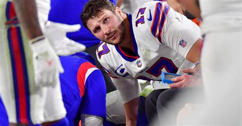 Josh Allen Injury Update Bills Qb In Walking Boot After Ot Loss To