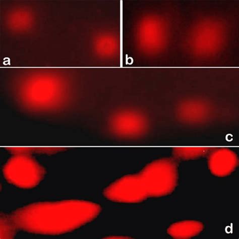 Single Cell Gel Electrophoresis Showing DNA Damage Fluorescing Around