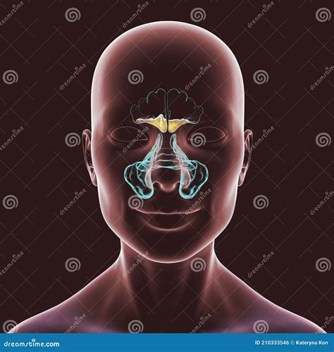 Sinusitis Inflammation Of Paranasal Cavities 3D Illustration Showing