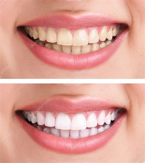 Healthy Teeth And Smile — Stock Photo © Luckybusiness 14351475