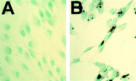 Antisense Cd44 Induces Schwann Cell Apoptosis Primary Rat Schwann