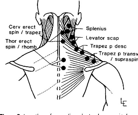 Emg Test Neck