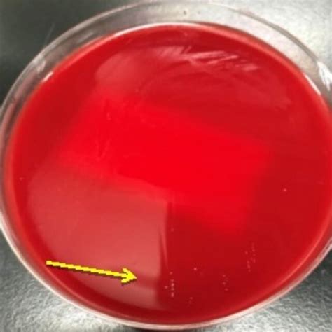 Needle Tip Colonies Appeared On The Blood Agar Plate 48 H After