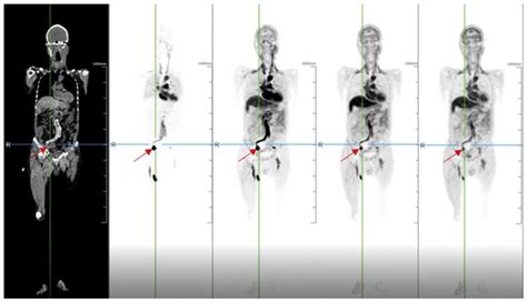 Diagnostics Free Full Text Advantages And Applications Of Total