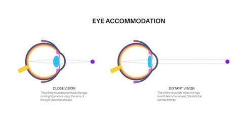 Premium Vector | Eye accommodation poster