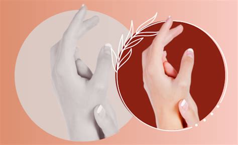 Hand Sweating Causes And Treatment Farashti Health Beauty And