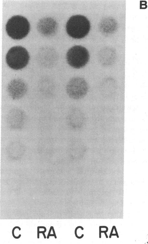 Northern Blot And Dot Blot Hybridizations Of Polya Rna Isolated From