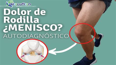 Qu Son Los Meniscos De La Rodilla Y Cu Les Son Sus Lesiones