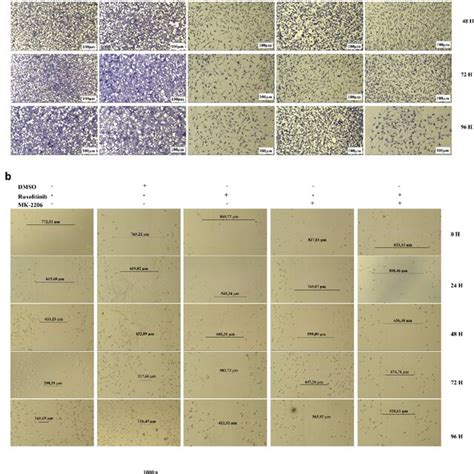 Determination Of The Metastatic Effect Of Ruxolitinib And Mk On