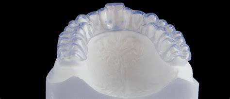 Occlusal Splints Ultralight Dental Appliances