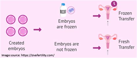 Frozen Embryo Transfers 6 Things To Know Saraogi Ivf Centre