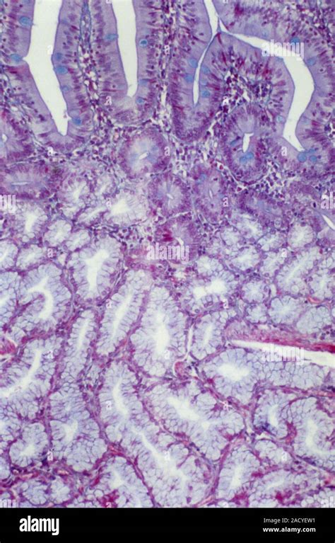 Small Intestine Lining Light Micrograph Of A Section Through The Healthy Mucosal Lining Of The