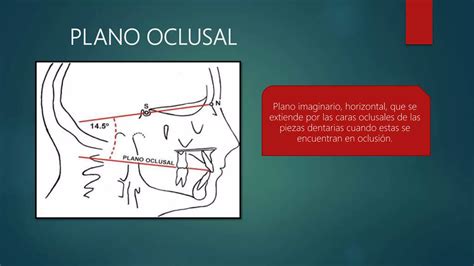 Tecnicas Radiograficas Intrabucales Ppt