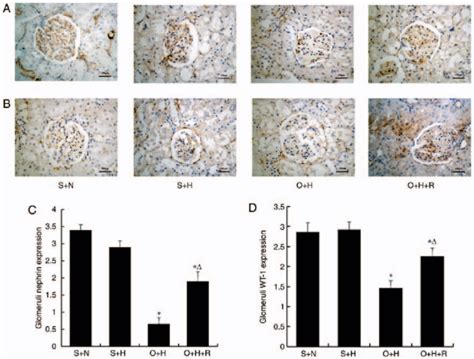 Immunohistochemical Staining For A Nephrin And B WT 1 In Glomeruli