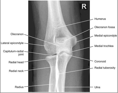 Ap Elbow Labeling Diagram Quizlet