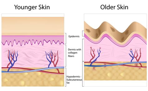 Skin Rejuvenation