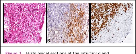 Figure 1 from MEN 2 syndrome masquerading as MEN 1 | Semantic Scholar