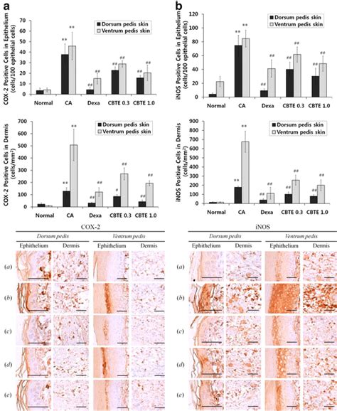 Representative Immunohistochemical Profiles Of Cox 2 And Inos On The