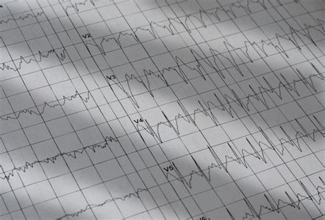 Gráfico Del Electrocardiograma Análisis Del Corazón Imágenes Del Cerebro Foto Premium