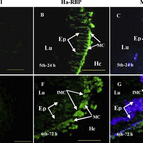 Immunohistochemical Analysis Of The Localization Of Ha Rbp In The