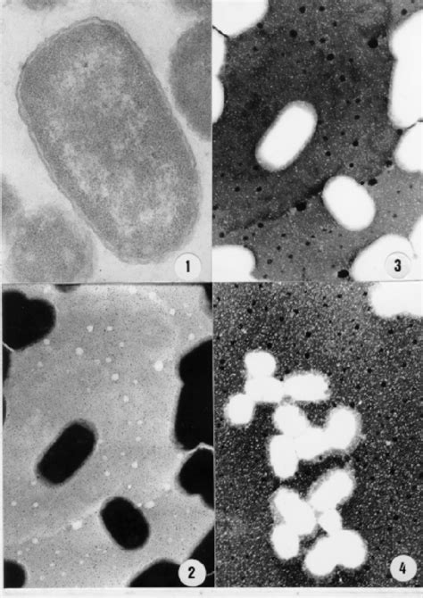 Thin Section Of Enteropathogenic Escherichia Coli Epec Serotype Download Scientific Diagram