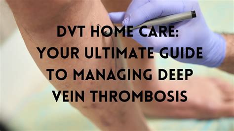 Unmasking The Silent Threat Understanding Deep Vein Thrombosis Dvt Youtube