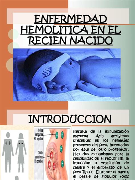 Enfermedad Hemolitica En El Recien Nacido Enfermedades Y Trastornos Medicina