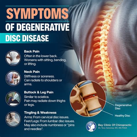 degenerative disc disease   chiropractic treatment